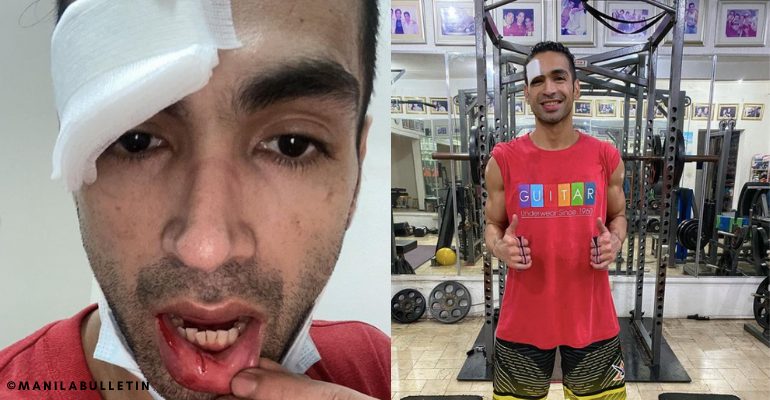 Carlos Agassi gets 10 stiches after home gym accident