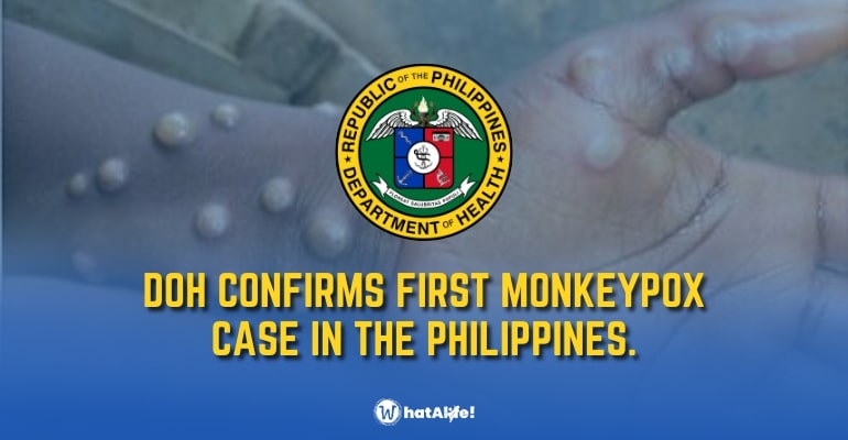 DOH confirms the first case of monkeypox in the Philippines