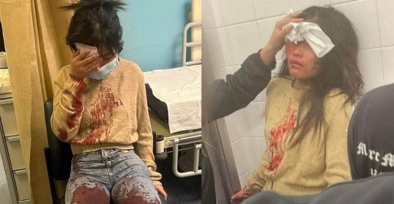 A young girl, 12, is viciously beaten up outside a busy McDonald