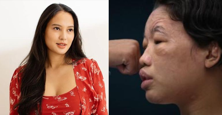 isabelle daza initiates fundraising campaign to aid helper blinded by abusive employers