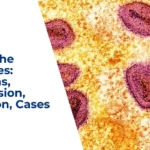 mpox in the philippines symptoms transmission prevention cases